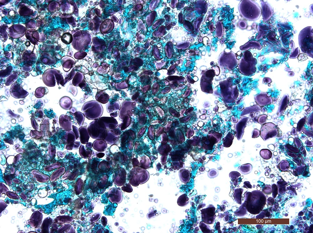 Figure 2b -small